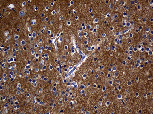 Immunohistochemical staining of paraffin-embedded Human adult brain tissue within the normal limits using anti-RGS17 mouse monoclonal antibody