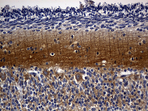 Immunohistochemical staining of paraffin-embedded Human embryonic cerebellum within the normal limits using anti-RGS17 mouse monoclonal antibody