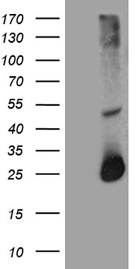 HEK293T cells were transfected with the pCMV6-ENTRY control (Left lane) or pCMV6-ENTRY RGS17 (Right lane) cDNA for 48 hrs and lysed