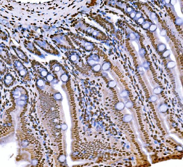  IHC analysis of Histone H1