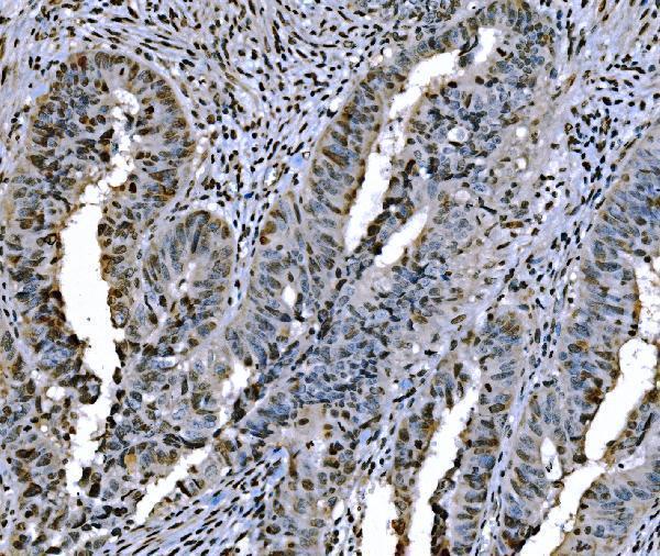 m08821 2 h1f0 primary antibodies ihc testing 4