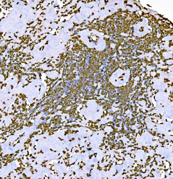 m08821 2 h1f0 primary antibodies ihc testing 5