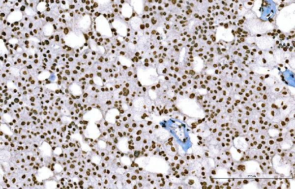 m08821 2 h1f0 primary antibodies ihc testing 6