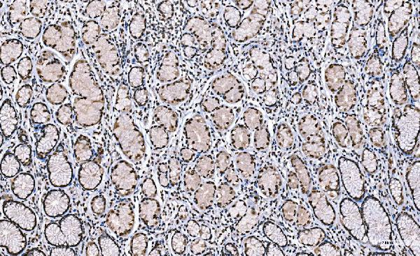 m08821 2 h1f0 primary antibodies ihc testing 8