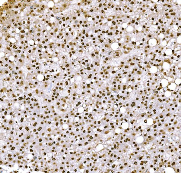 m08821 2 h1f0 primary antibodies ihc testing 9