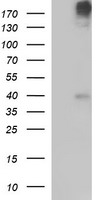 HEK293T cells were transfected with the pCMV6-ENTRY control (Left lane) or pCMV6-ENTRY PLB1 (Right lane) cDNA for 48 hrs and lysed