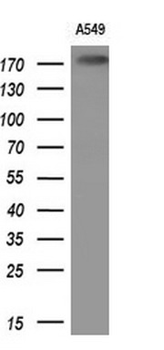 Western blot analysis of extracts (10ug) from 1 cell lines by using anti-PLB1 monoclonal antibody (1:200)