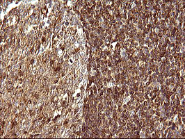 m08823 anti scamp2 mouse monoclonal antibody clone id oti3c2 ihc testing 11
