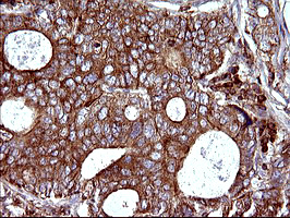 m08823 anti scamp2 mouse monoclonal antibody clone id oti3c2 ihc testing 12