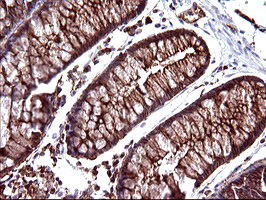 m08823 anti scamp2 mouse monoclonal antibody clone id oti3c2 ihc testing 13