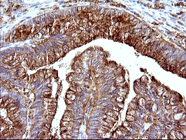 m08823 anti scamp2 mouse monoclonal antibody clone id oti3c2 ihc testing 14