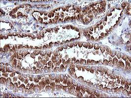 m08823 anti scamp2 mouse monoclonal antibody clone id oti3c2 ihc testing 15