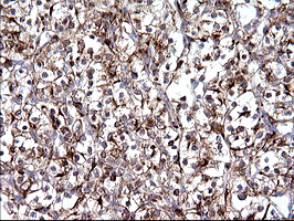 m08823 anti scamp2 mouse monoclonal antibody clone id oti3c2 ihc testing 16