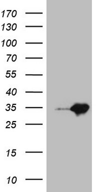 HEK293T cells were transfected with the pCMV6-ENTRY control (Left lane) or pCMV6-ENTRY MED30 (Right lane) cDNA for 48 hrs and lysed