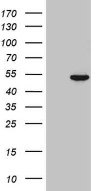 m08840 anti jmjd5 kdm8 mouse monoclonal antibody clone id oti5e8 wb testing 1