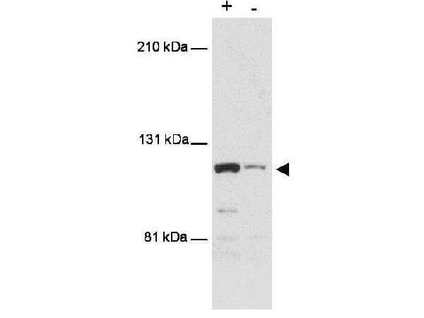 m08842 mtbp primary antibodies wb testing 1