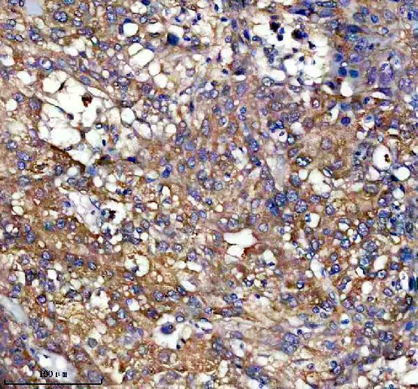 IHC analysis of PEX11B using anti-PEX11B antibody (M08864)