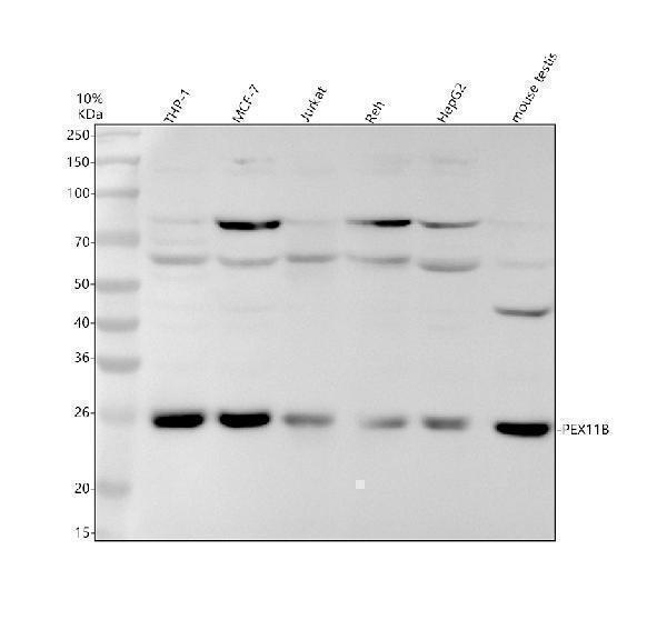 Western blot analysis of PEX11B using anti-PEX11B antibody (M08864)