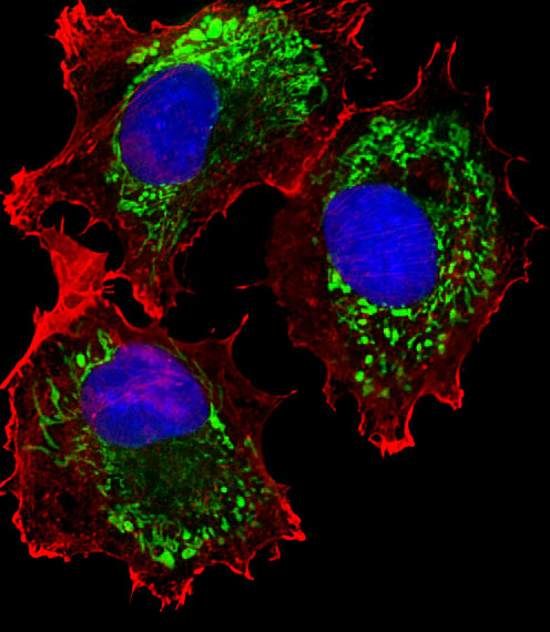 m08868 anti aldh6a1 antibody if testing 1