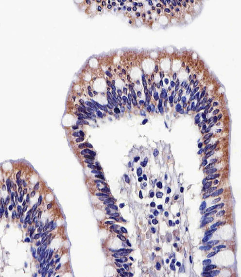 m08868 anti aldh6a1 antibody ihc p testing 3