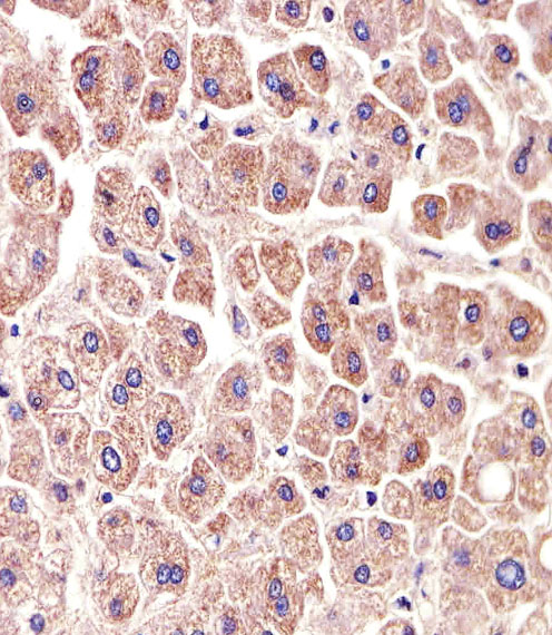 m08868 anti aldh6a1 antibody ihc p testing 4