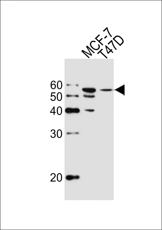m08868 anti aldh6a1 antibody wb testing 2
