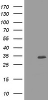HEK293T cells were transfected with the pCMV6-ENTRY control (Left lane) or pCMV6-ENTRY CUEDC2 (Right lane) cDNA for 48 hrs and lysed
