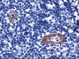 m08888 anti lmcd1 mouse monoclonal antibody clone id oti1h5 ihc testing 2