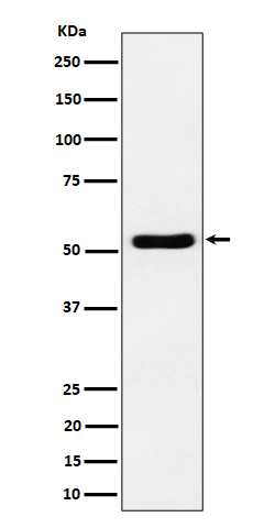 Western blot analysis of GPRC5B expression in Jurkat cell lysate.