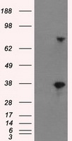 HEK293T cells were transfected with the pCMV6-ENTRY control (Left lane) or pCMV6-ENTRY BTN3A2 (Right lane) cDNA for 48 hrs and lysed. Equivalent amounts of cell lysates (5 ug per lane) were separated by SDS-PAGE and immunoblotted with anti-BTN3A2.