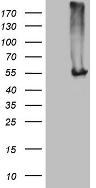 HEK293T cells were transfected with the pCMV6-ENTRY control (Left lane) or pCMV6-ENTRY NARS2 (Right lane) cDNA for 48 hrs and lysed. Equivalent amounts of cell lysates (5 ug per lane) were separated by SDS-PAGE and immunoblotted with anti-NARS2 (1:500).