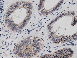 m08918 anti dnaja2 mouse monoclonal antibody clone id oti3a10 ihc testing 6