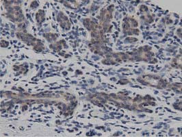 m08918 anti dnaja2 mouse monoclonal antibody clone id oti3a10 ihc testing 7