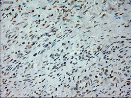 Immunohistochemical staining of paraffin-embedded Ovary tissue within the normal limits using anti-PROM2mouse monoclonal antibody