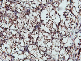 m08954 anti apmap mouse monoclonal antibody clone id oti4f6 ihc testing 14