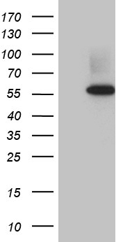 HEK293T cells were transfected with the pCMV6-ENTRY control (Left lane) or pCMV6-ENTRY RNF14 (Right lane) cDNA for 48 hrs and lysed