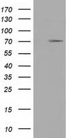 HEK293T cells were transfected with the pCMV6-ENTRY control (Left lane) or pCMV6-ENTRY TRIM2 (Right lane) cDNA for 48 hrs and lysed