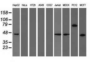 Western blot analysis of extracts (35ug) from 9 different cell lines by using anti-TRIM2 monoclonal antibody