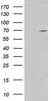 HEK293T cells were transfected with the pCMV6-ENTRY control (Left lane) or pCMV6-ENTRY TRIM2 (Right lane) cDNA for 48 hrs and lysed
