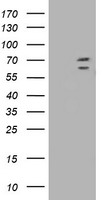 HEK293T cells were transfected with the pCMV6-ENTRY control (Left lane) or pCMV6-ENTRY TRIM2 (Right lane) cDNA for 48 hrs and lysed