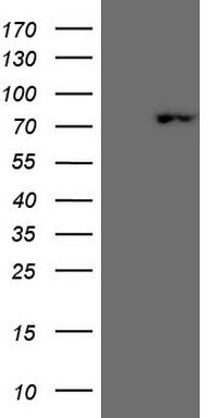 HEK293T cells were transfected with the pCMV6-ENTRY control (Left lane) or pCMV6-ENTRY SCML2 (Right lane) cDNA for 48 hrs and lysed
