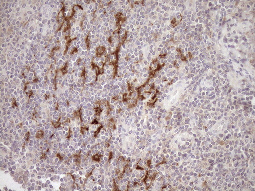 Immunohistochemical staining of paraffin-embedded Human tonsil within the normal limits using anti-SAMSN1 mouse monoclonal antibody