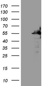 HEK293T cells were transfected with the pCMV6-ENTRY control (Left lane) or pCMV6-ENTRY SAMSN1 (Right lane) cDNA for 48 hrs and lysed