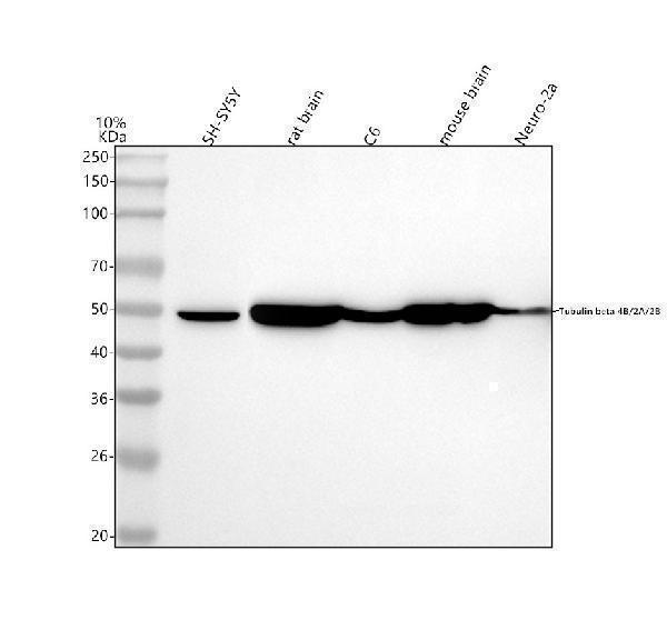 Western blot analysis of Tubulin beta 4B/2A/2B using anti-Tubulin beta 4B/2A/2B antibody (M09008)