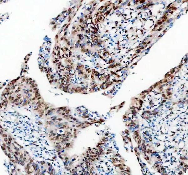 IHC analysis of HNRNPA0/MRC1 using anti-HNRNPA0/MRC1 antibody (M09015-1)