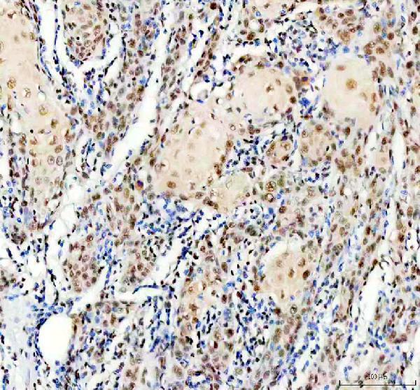 IHC analysis of HNRNPA0/MRC1 using anti-HNRNPA0/MRC1 antibody (M09015-1)