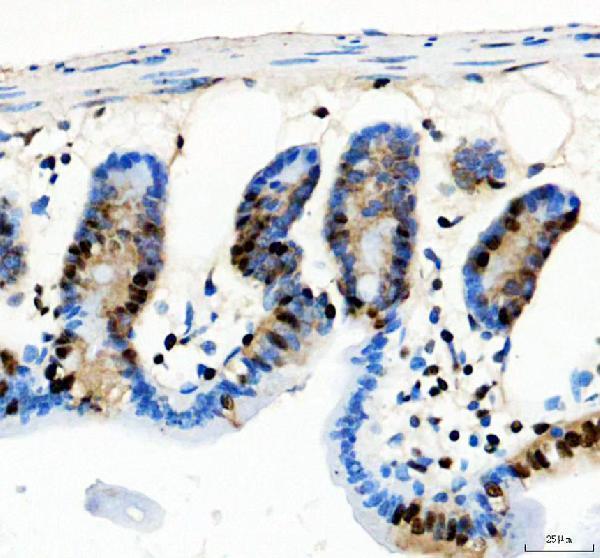 m09015 1 hnrnpa0 primary antibodies ihc testing 3