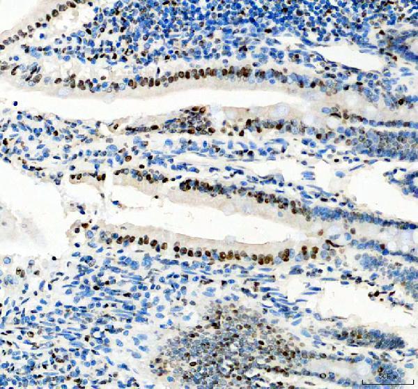 m09015 1 hnrnpa0 primary antibodies ihc testing 4