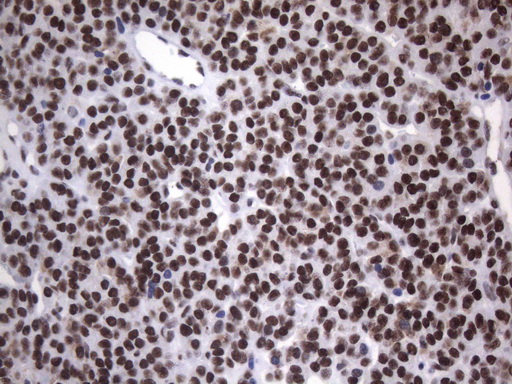 m09015 anti hnrnpa0 mouse monoclonal antibody clone id oti8h8 ihc testing 3