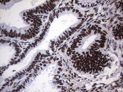 m09015 anti hnrnpa0 mouse monoclonal antibody clone id oti8h8 ihc testing 5